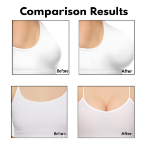 FlexiPatch™ - Breast Enlargement Patch