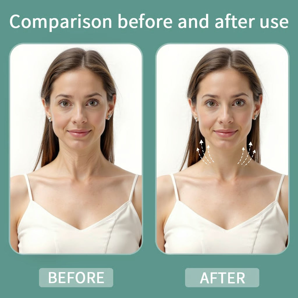 NeckLuxe™ - Instant Neck & Jawline Lift Tape Set
